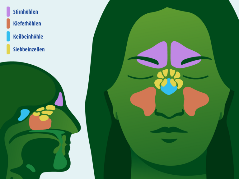 Infografik über die Lage der Nasenneben-höhlen.