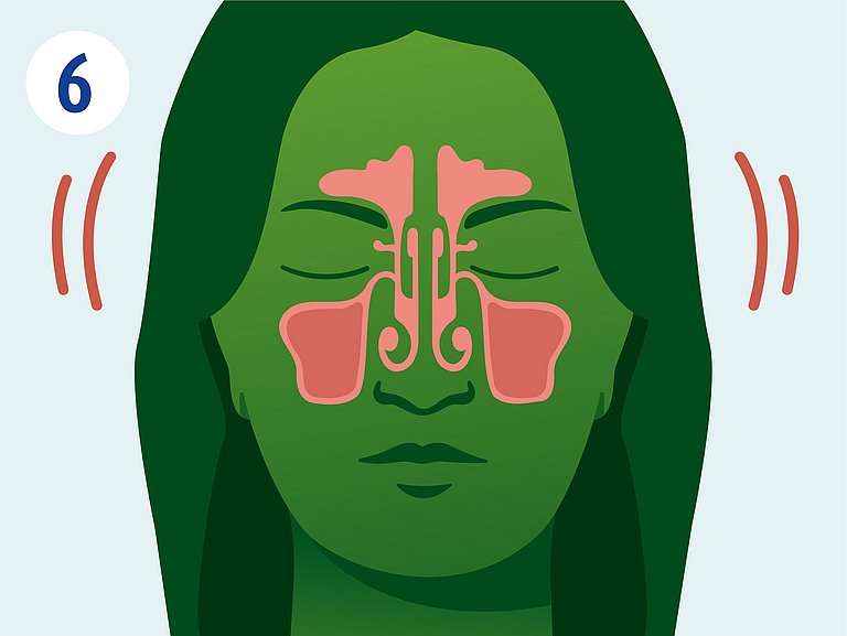 Infografik über Druckschmerzen bei Nasennebenhöhlenentzündung.